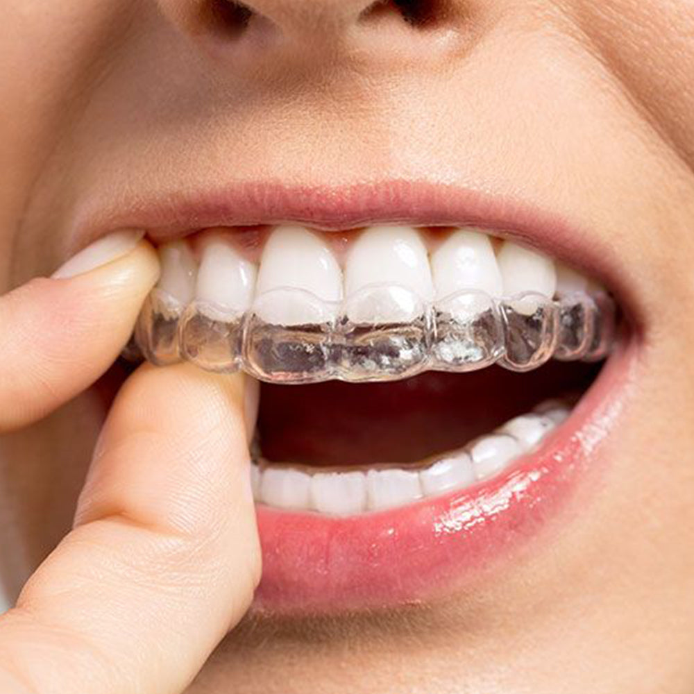 (For Existing Order Only，Please Do Not Buy Directly) Additional Retainer Add-on