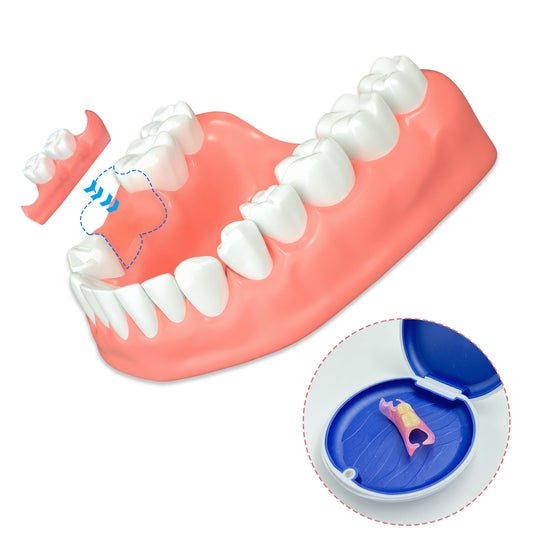 Each Additional Tooth – 55 USD
